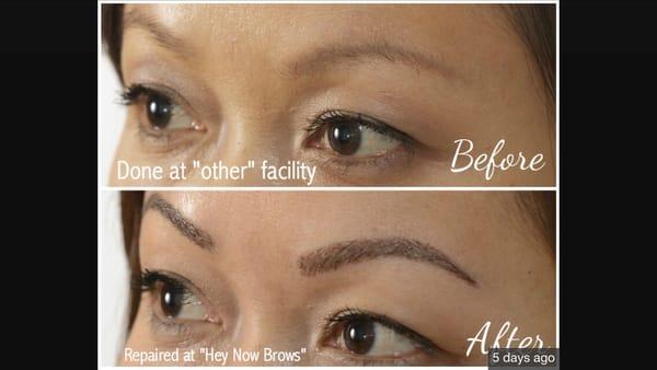 Check out this restored brow.  Previous tattoo from 20 years ago!!! Now restored to beautiful, feathered, hair stroke eyebrows!