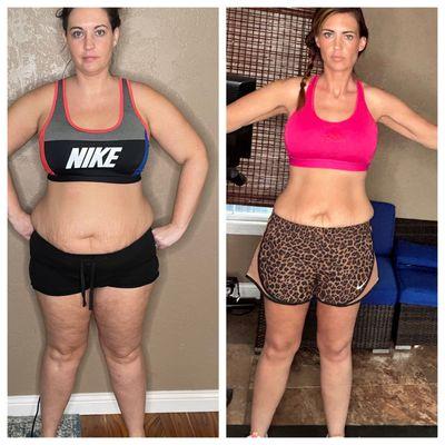 medical weight loss before and after