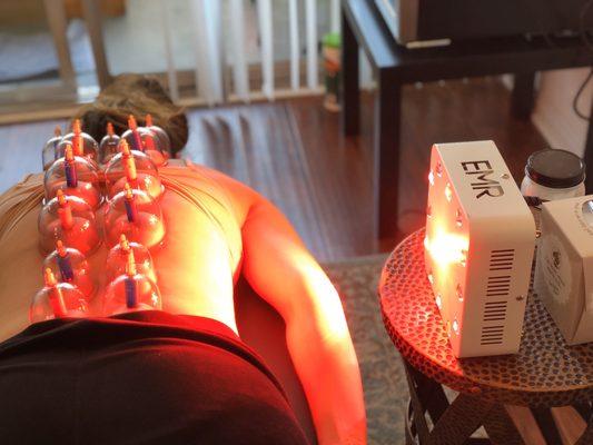 CBD red/infrared cupping...amazing!