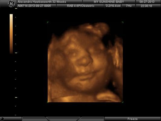 Baby Ava at 32 Weeks.