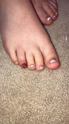 cut up toe