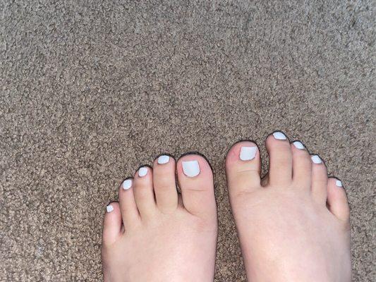 Far away the toenails actually don't look so bad