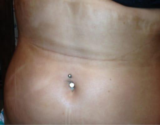 Stomach after spray tan :(