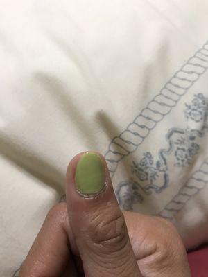 Left side of nail is chopped off