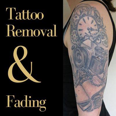 Best Northshore Tattoo Removal uses the enlighten III laser by Cutera.