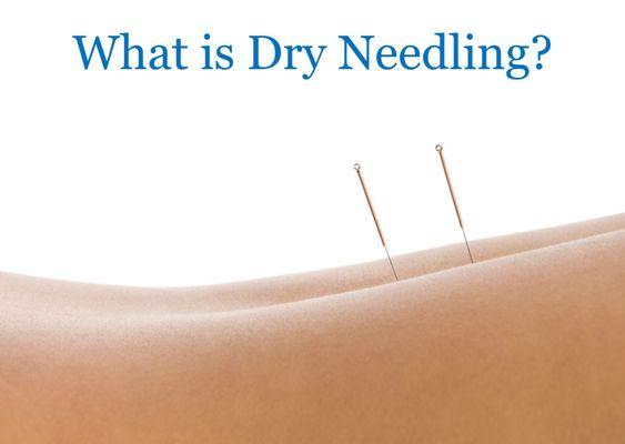 We offer Dry Needling, which is a safe and effective treatment for a variety of conditions.