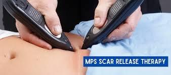 MPS Scar Release Therapy