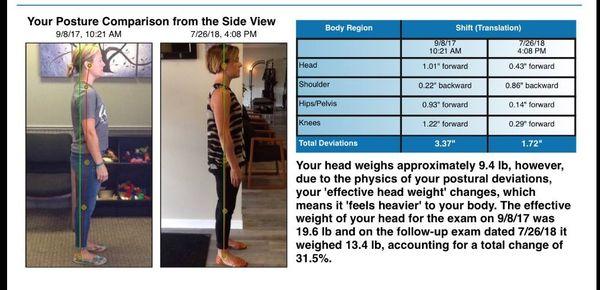 Posture is vital for your overall health and wellness