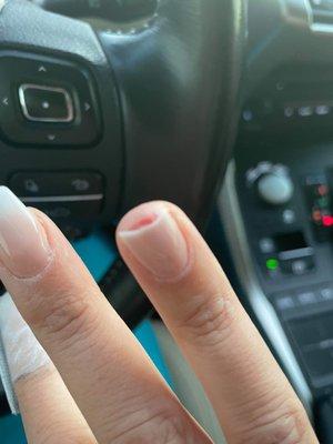 Real nails ruined