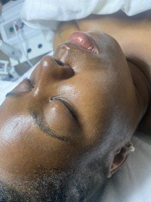 Hydrating facial