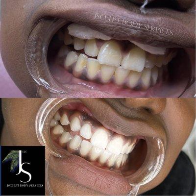 Teeth whitening training classes 
Start your new career today !