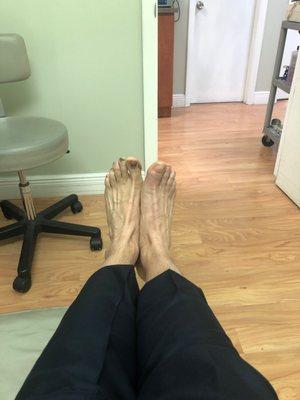 Post marathon feet