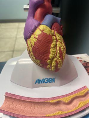 Heart model