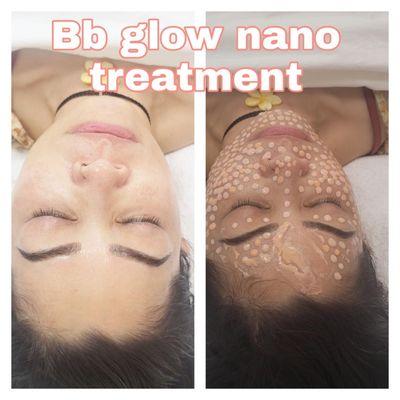 BB glowing treatment