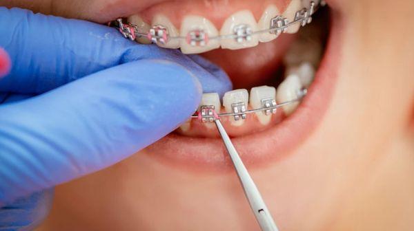 Quest Orthodontics: Dr. Arjun Patel