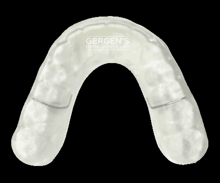 Splint fabricated in the USA by David Gergen from Gergen's Orthodontic Lab