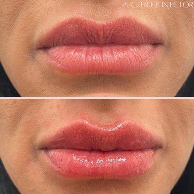 Keeping it natural with yearly lip touch up!  Because fabulous lips never go out of style.