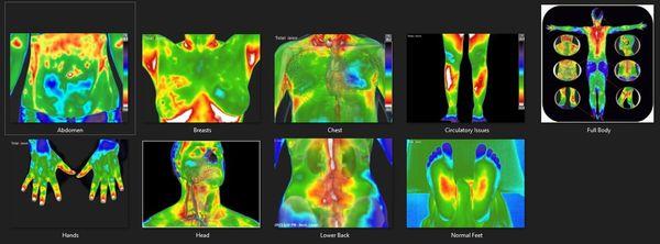 Unlock a spectrum of health insights with our diverse range of scan types, tailored to meet your individual needs.