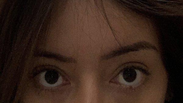 one week after: (yes I'm lifting my brow a bit because I have a lazy eye lol)