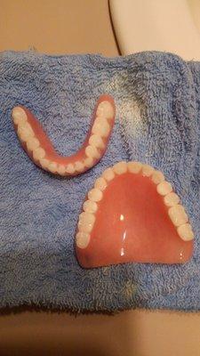 The top Dentures are completely different once returned after being finalized than they were during wax tryin.