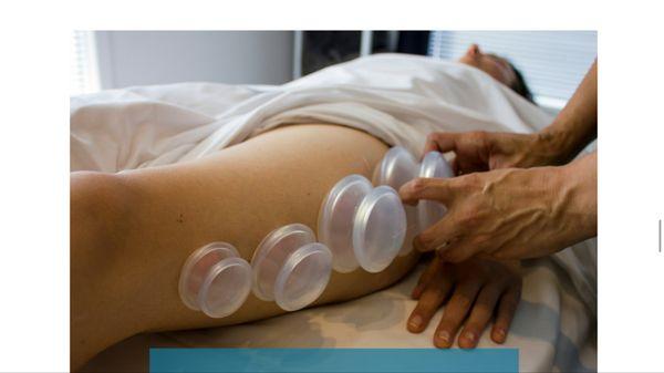 Cupping to assist release your knots and relieve your muscles