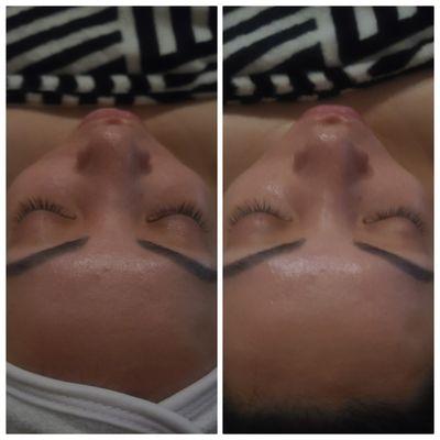 *custom* EUROPEAN FACIAL [1 hour]
Duration: 1.5 hours with add ons: microdermabrasion+ hydrojelly Antioxidant Goji Mask+ High Frequency