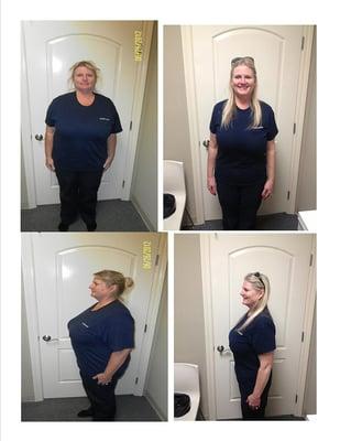 Leann Lost 72 Lbs! Weight Loss Results Huntington Beach