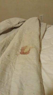 Blood stained bed cover