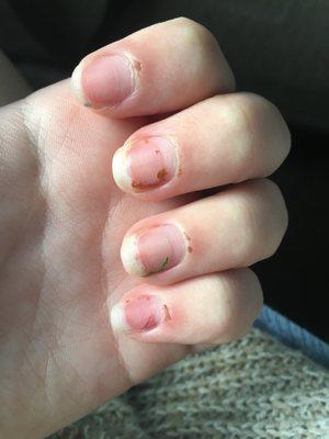 nailbeds