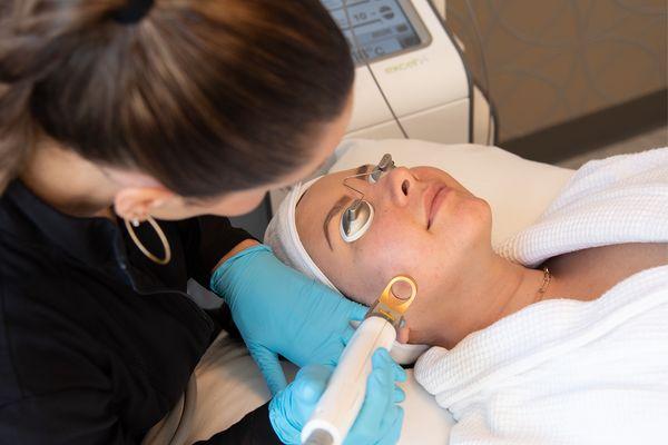 Limelight IPL Facial