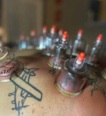 Cupping