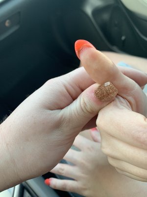 Cut thumb both skin and natural nail