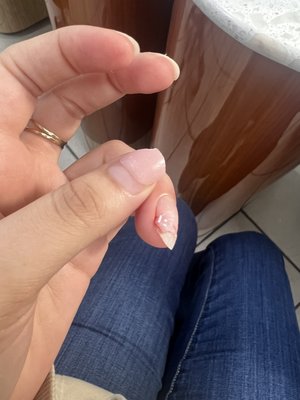 She ripped part of my nail off!