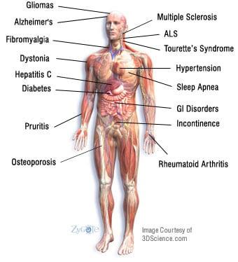 Cannabis facts on the beneficial medicinal positive effect on the body for all the things listed on diagram.