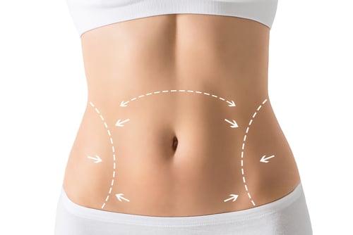 Tummy Tuck Surgeon