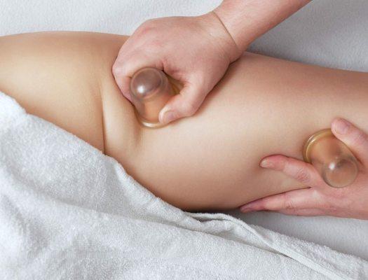 Cupping therapy is an ancient Chinese technique that pulls blood to the tissues and helps release connective tissue deeper below the skin