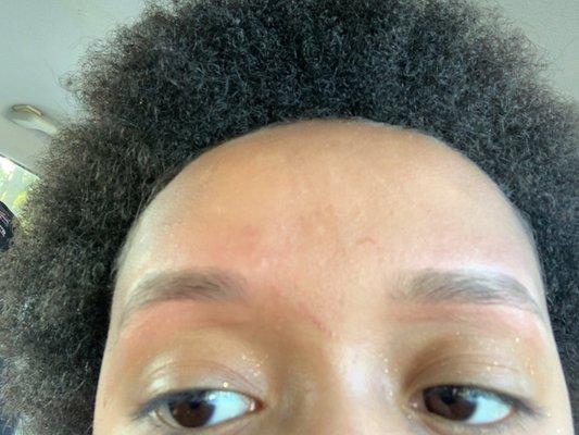 Irritated skin because she didn't sanitize or clean my brows before she did them.