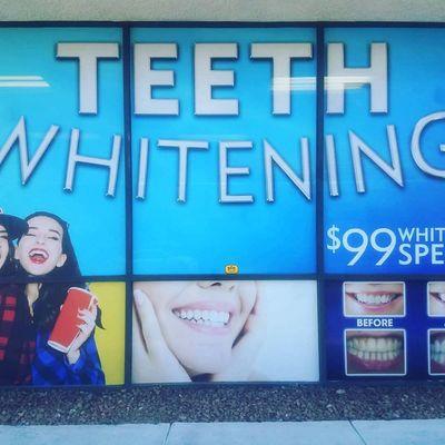 Pureteethwhiteninglv.com