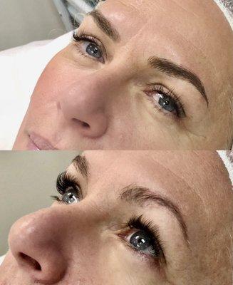 Microblading