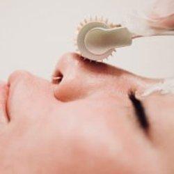 PRP Vampire Facial Treatment