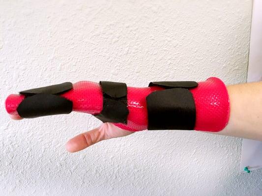 static wrist splint