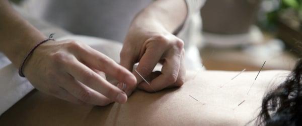 Amber Milanovich Acupuncture