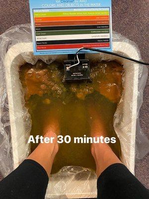 Results after a 30 minute detox foot bath