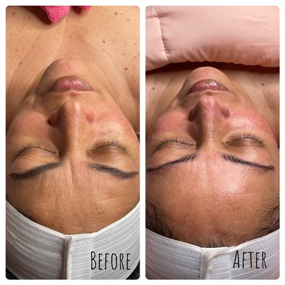 Anti-Aging Facial with Gua Sha Add On