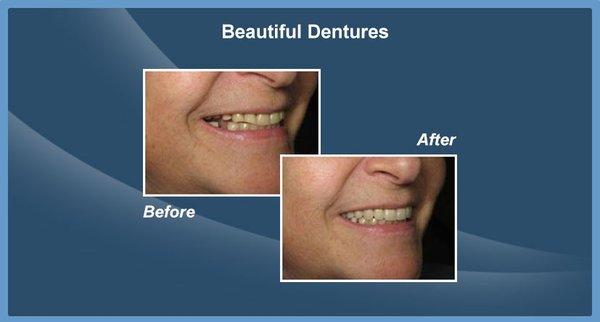 Smiles Makeover Dentist Spring TX 77379, Cosmetic Dentistry