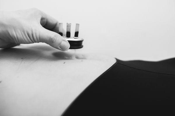 Moxibustion - a warming treatment that when done on the belly can help with stomach pain and period cramps.