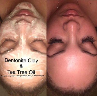 Bentonite Clay & Tea Tree Oil keeps our skin clean, especially for people like me that have larger pores, oily skin, and are prone to acne.