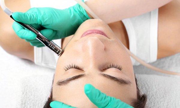 Micro-Dermabrasion Facial