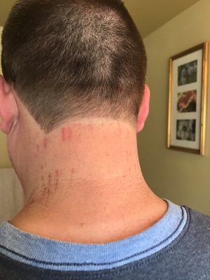 Scratches from their clippers