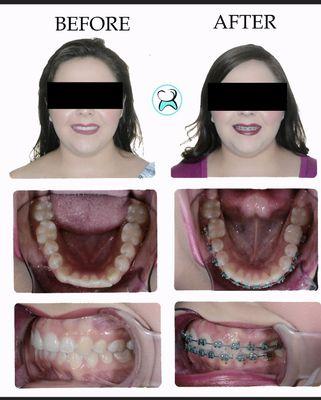 Orthodontics